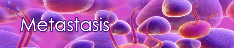 Metastasi